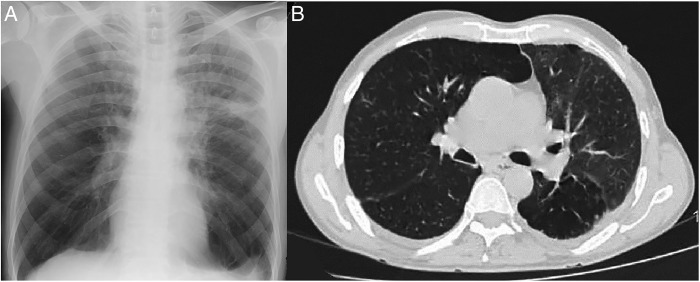 Figure 4