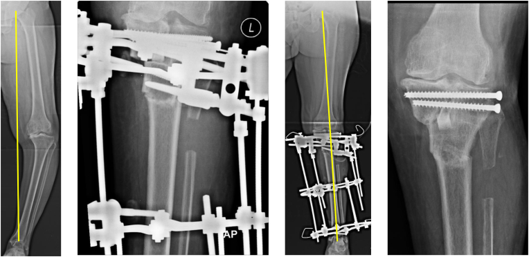 Fig. 3