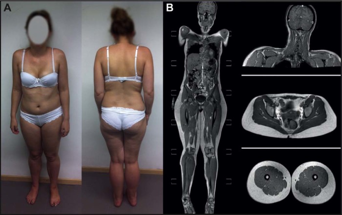 Fig. 2