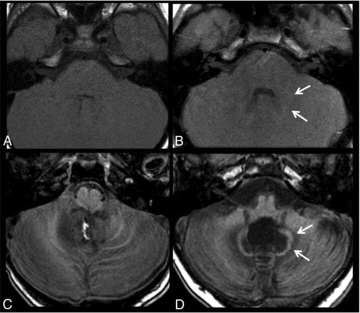 Fig 2.