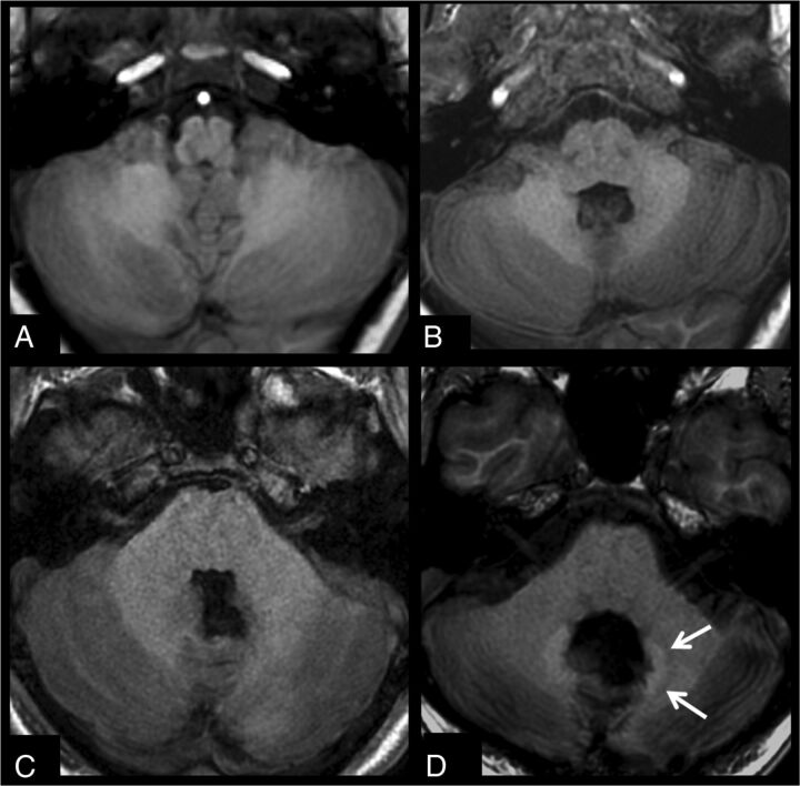 Fig 3.