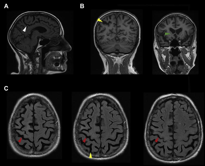 Fig. 1