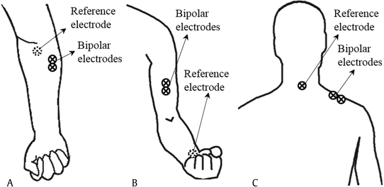 Fig. 1