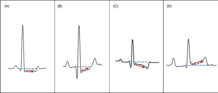 FIG 1