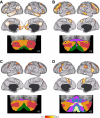 Fig. 14.