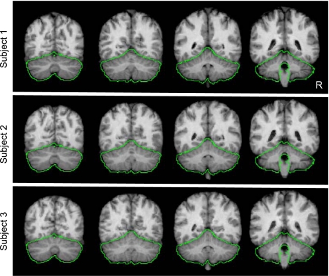 Fig. 3.