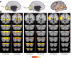 Fig. 12.