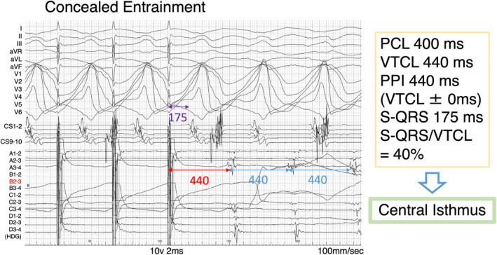 FIGURE 4