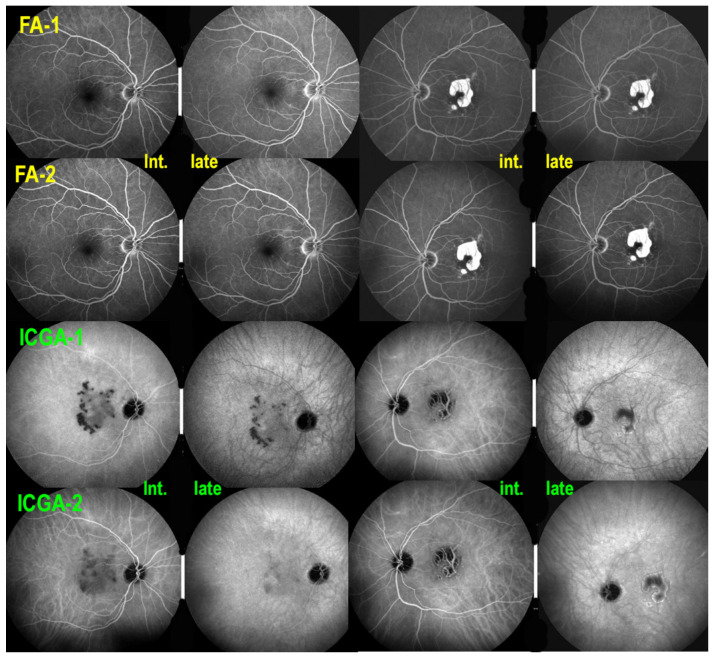 Figure 17