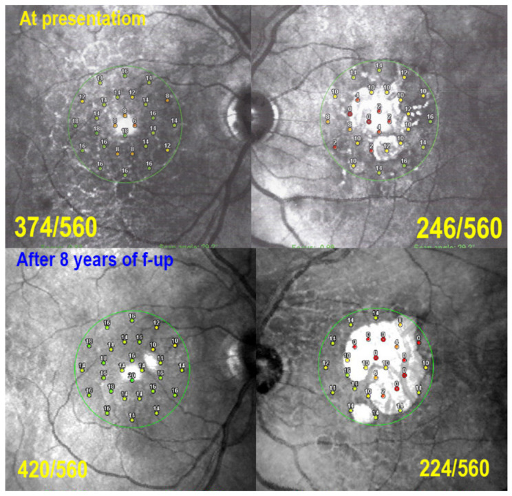 Figure 19