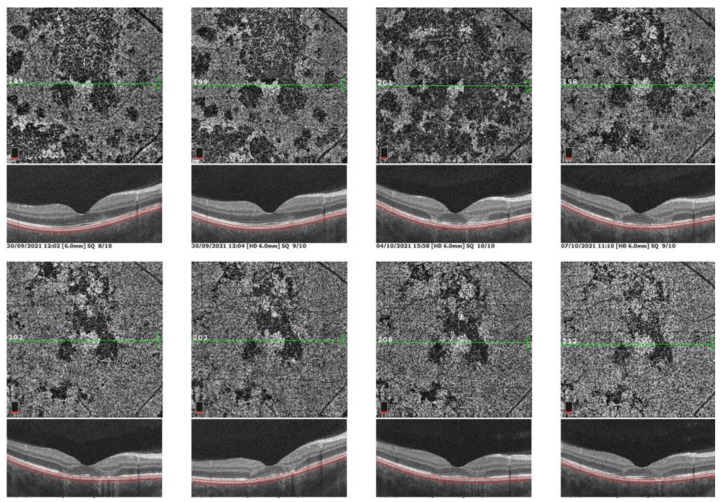 Figure 12