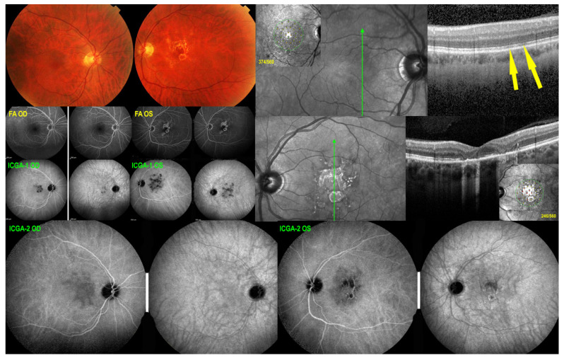 Figure 16