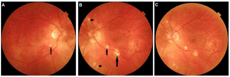 Figure 15