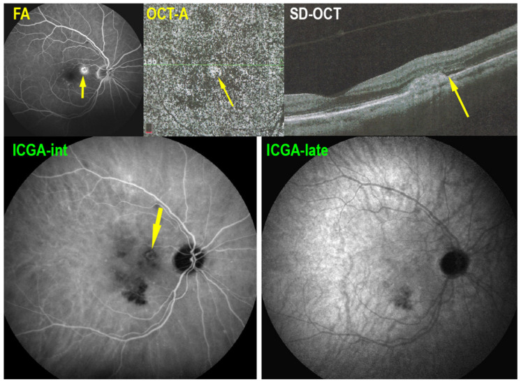 Figure 18