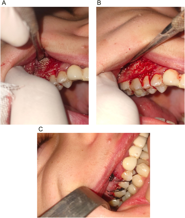 Fig. 4