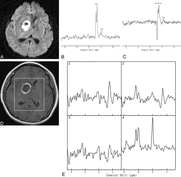 Fig 3.