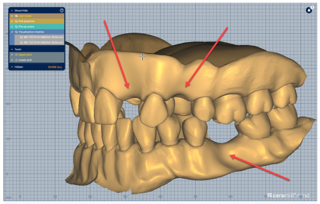 Figure 11