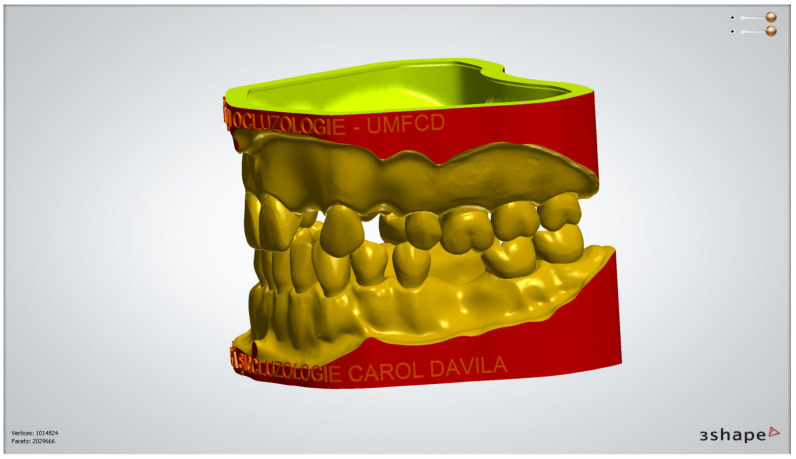 Figure 13