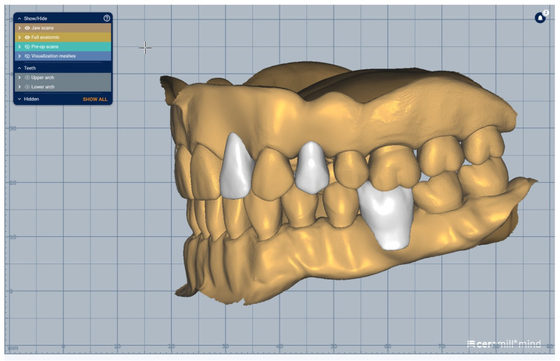 Figure 12