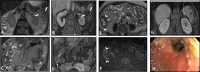 Fig. 14