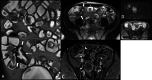 Fig. 12