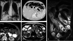 Fig. 18