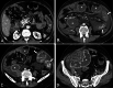 Fig. 17