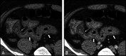 Fig. 11
