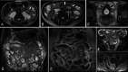 Fig. 15