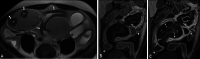 Fig. 21