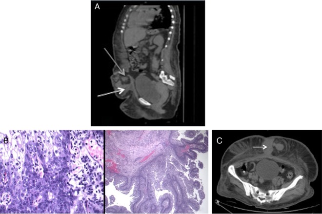 Figure 1