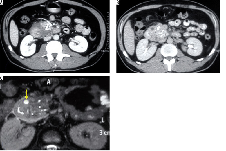 Figure 11