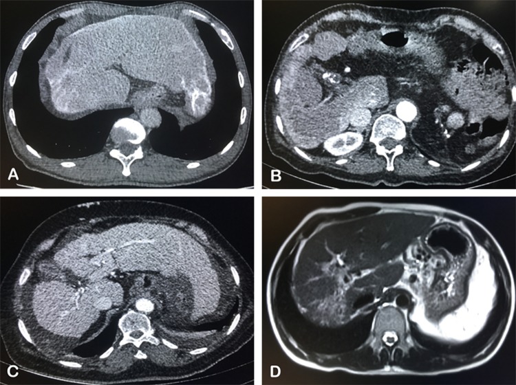 Fig. 1