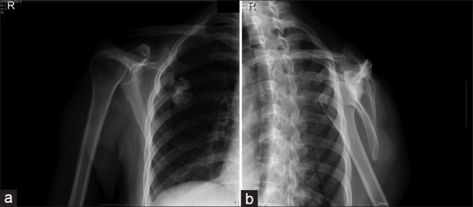 Figure 1 (a,b)