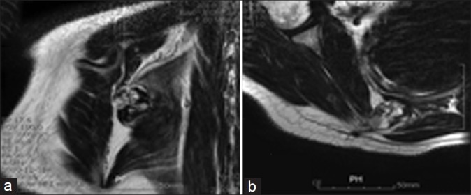 Figure 3 (a, b)