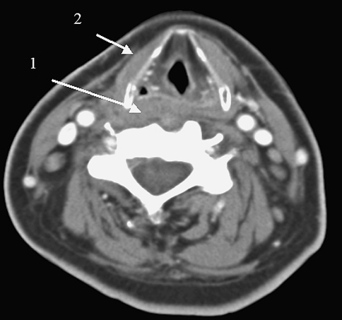 Fig. 6