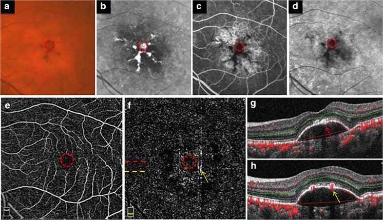 Fig. 3