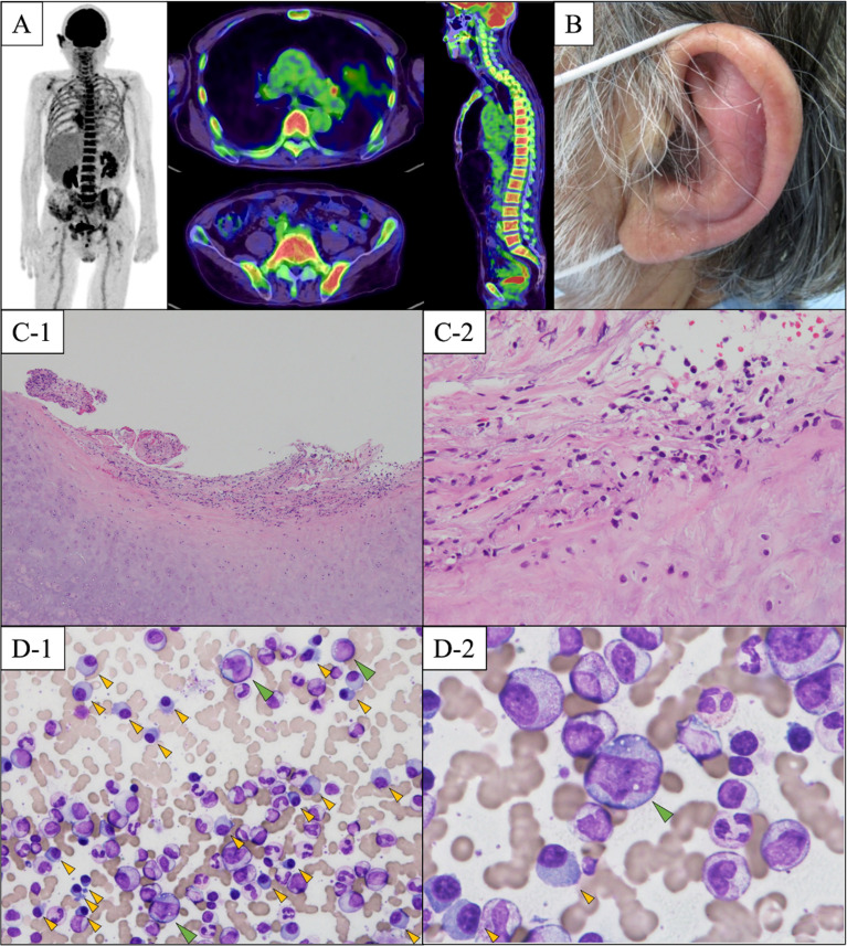 Figure 2