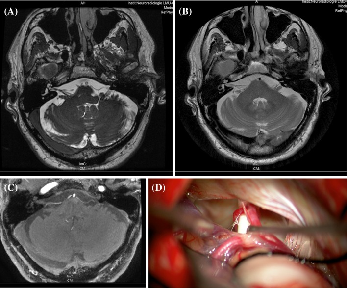 Fig. 2