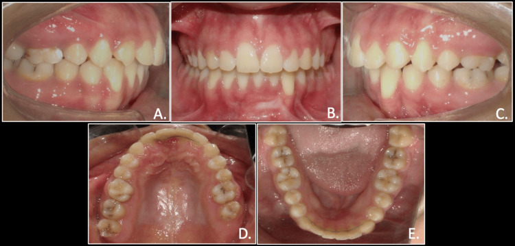 Figure 11