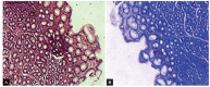 Figs 3A and B: