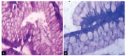 Figs 2A and B: