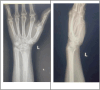 Fig. 9
