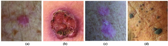 Fig. 2