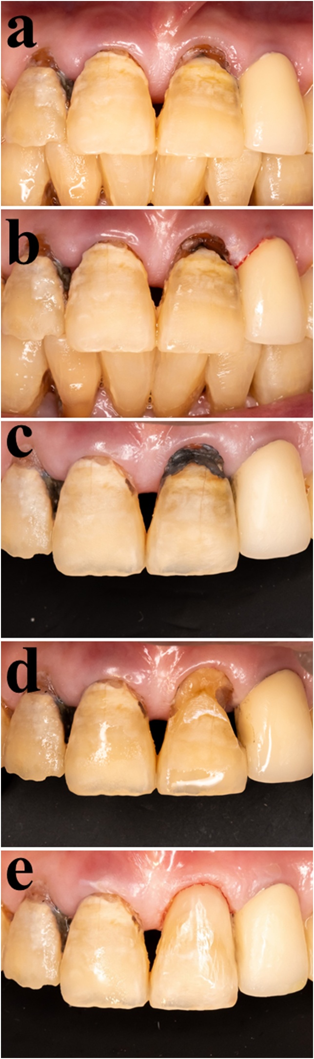 Fig. 3