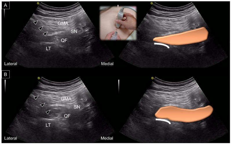 Figure 14