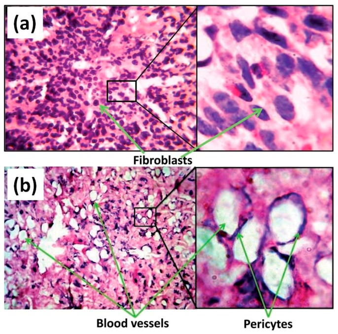 Figure 22