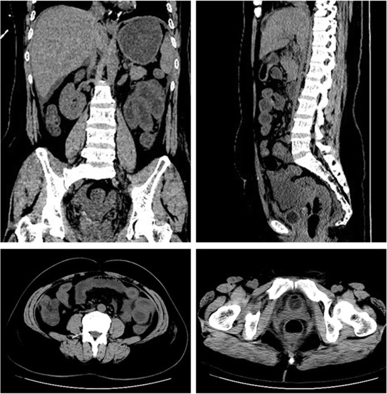 Fig. 2