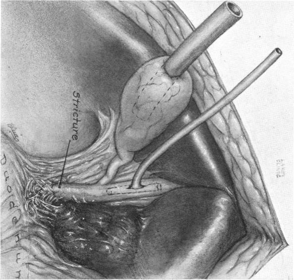 FIG. 13.