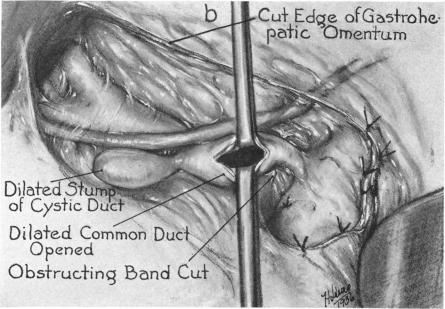 FIG. 14. b